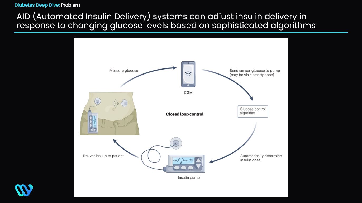 AID closed-loop system